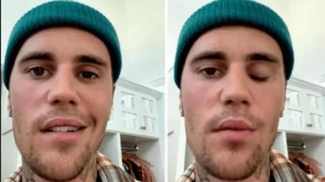 Justin Bieber dünya turnesine çıkamıyor