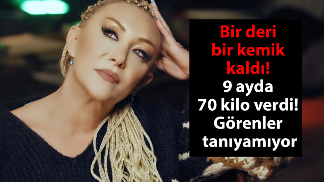 Bir deri bir kemik kaldı! Şarkıcı Güllü 9 ayda 70 kilo verdi! Görenler tanıyamıyor